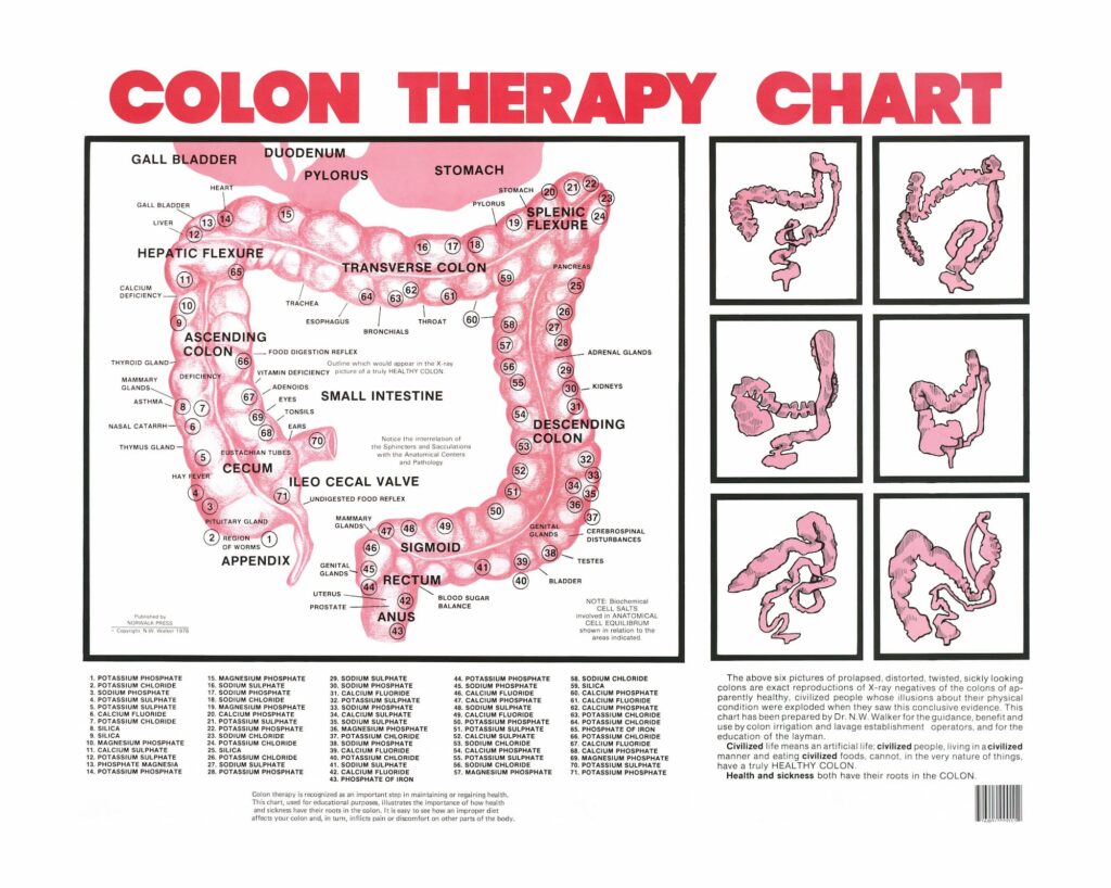 Colon therapy chart detailing digestive system anatomy and related glands, with images of various colon shapes and conditions