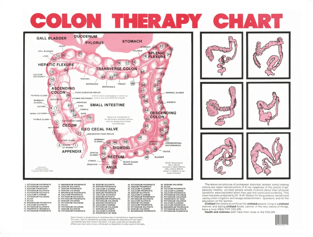 Colon therapy chart detailing anatomy, functions, and health implications of the digestive system with illustrations.
