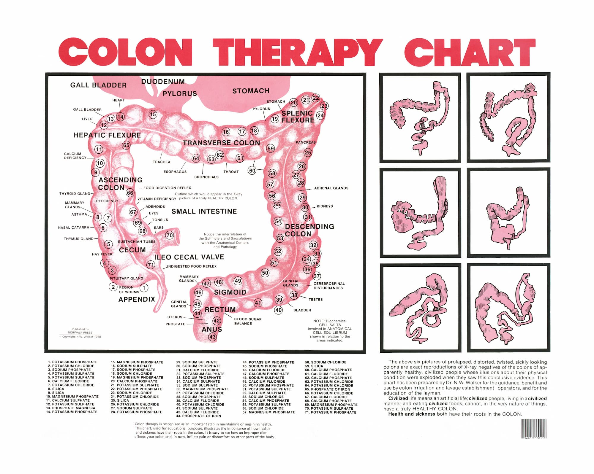 Colon therapy chart detailing digestive system anatomy and related glands, with images of various colon shapes and conditions